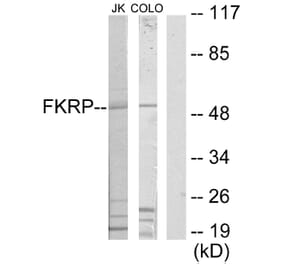 Western Blot - Anti-FKRP Antibody (C11711) - Antibodies.com