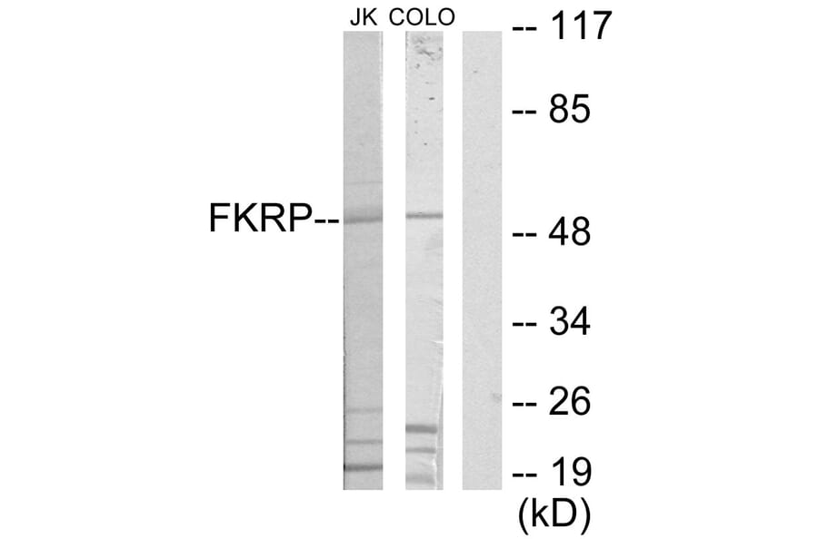 Western Blot - Anti-FKRP Antibody (C11711) - Antibodies.com