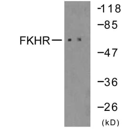 Western Blot - Anti-FKHR Antibody (B7086) - Antibodies.com