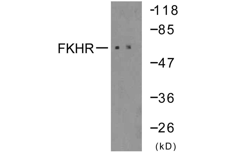 Western Blot - Anti-FKHR Antibody (B7086) - Antibodies.com