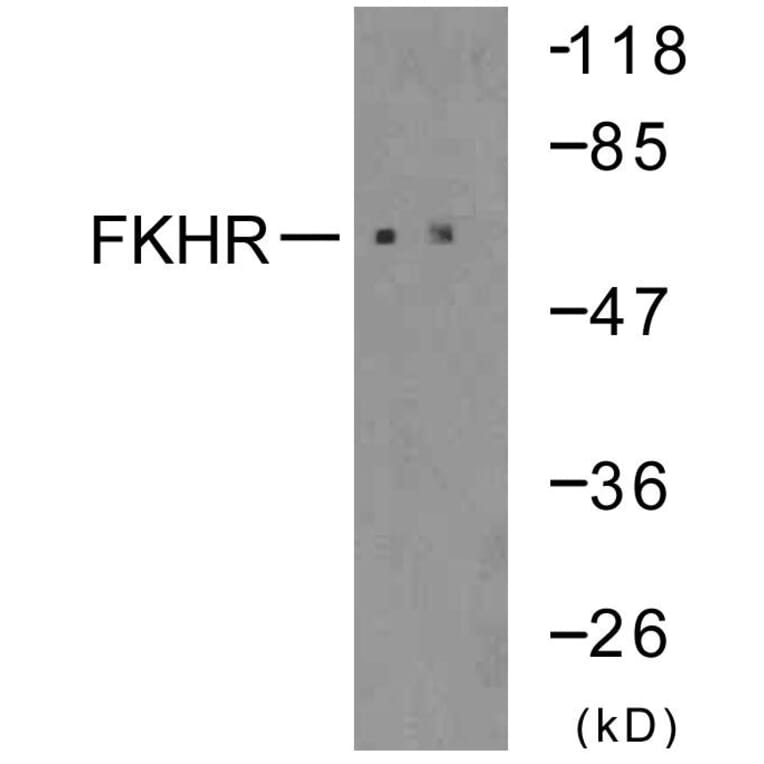 Western Blot - Anti-FKHR Antibody (B7086) - Antibodies.com