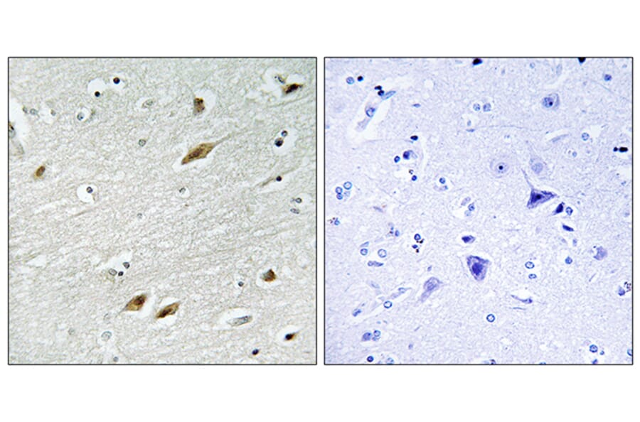 Immunohistochemistry - Anti-FKHR Antibody (B7086) - Antibodies.com