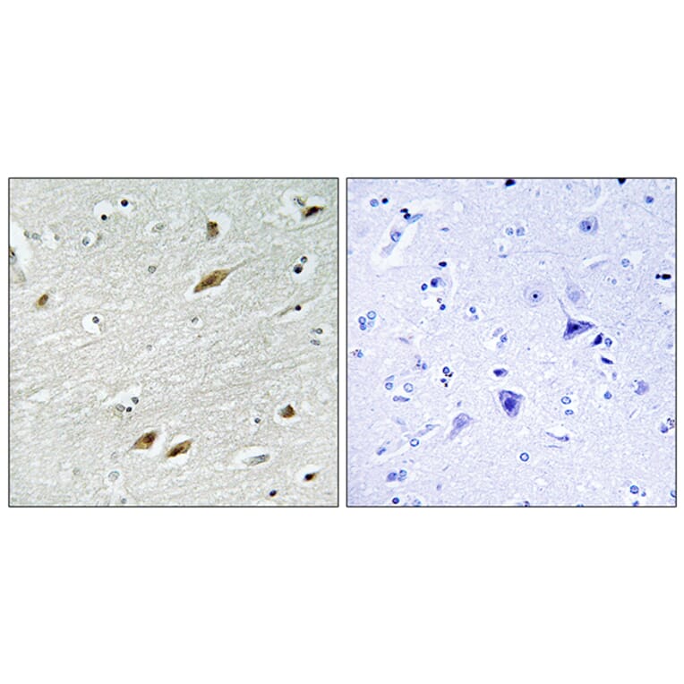 Immunohistochemistry - Anti-FKHR Antibody (B7086) - Antibodies.com