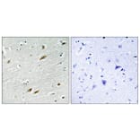 Immunohistochemistry - Anti-FKHR Antibody (B7086) - Antibodies.com