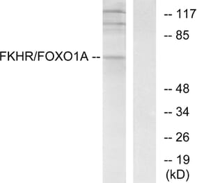 Western Blot - Anti-FKHR Antibody (B7085) - Antibodies.com