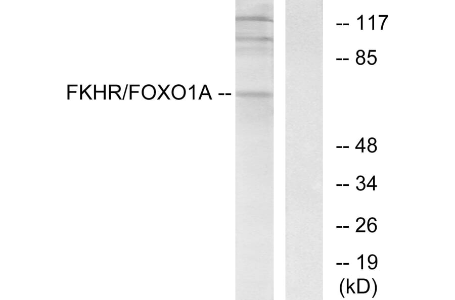 Western Blot - Anti-FKHR Antibody (B7085) - Antibodies.com