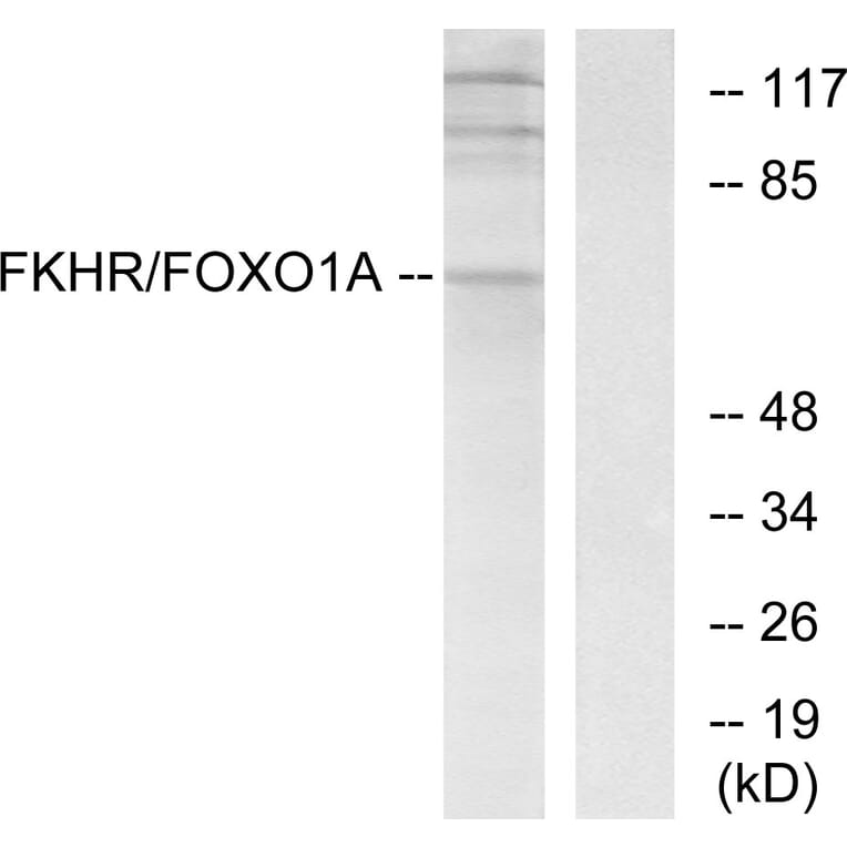 Western Blot - Anti-FKHR Antibody (B7085) - Antibodies.com