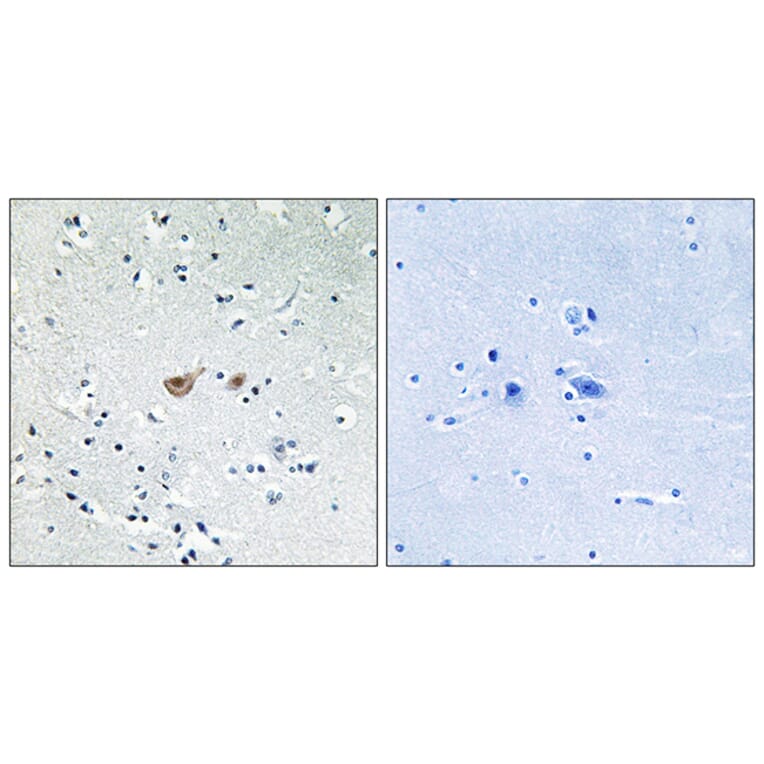 Immunohistochemistry - Anti-FKHR Antibody (B7085) - Antibodies.com