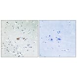 Immunohistochemistry - Anti-FKHR Antibody (B7085) - Antibodies.com