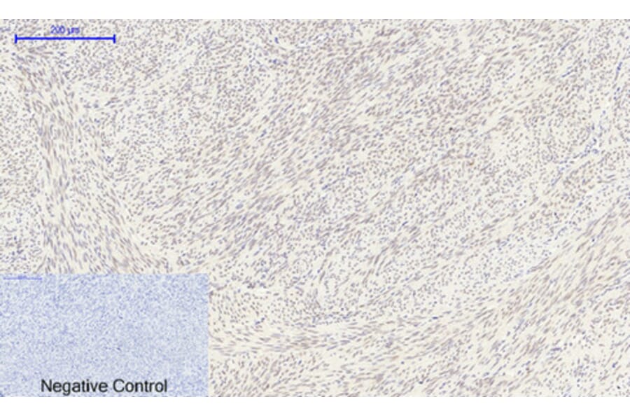 Immunohistochemistry - Anti-FKHR Antibody (B7085) - Antibodies.com