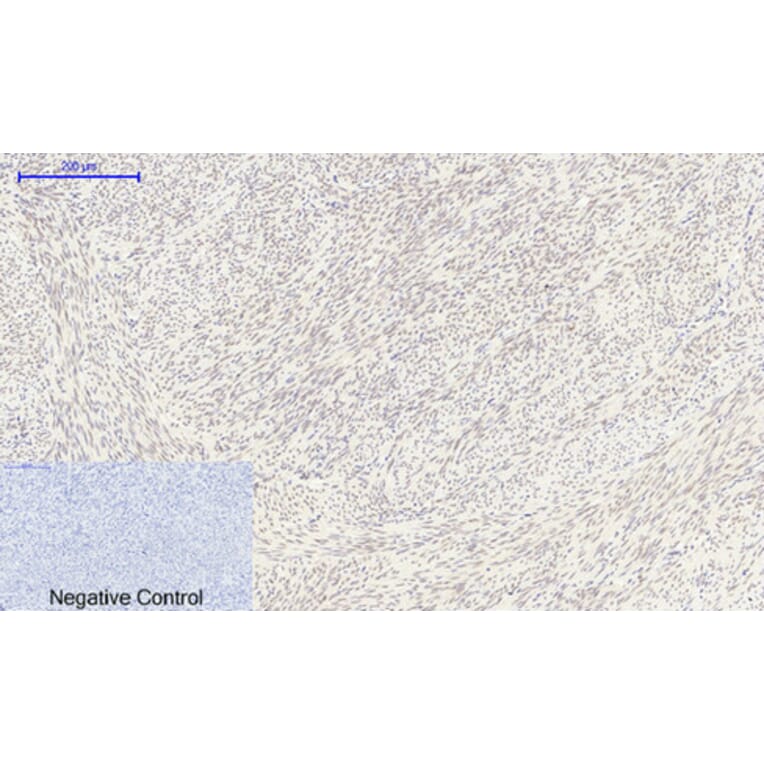 Immunohistochemistry - Anti-FKHR Antibody (B7085) - Antibodies.com