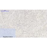 Immunohistochemistry - Anti-FKHR Antibody (B7085) - Antibodies.com