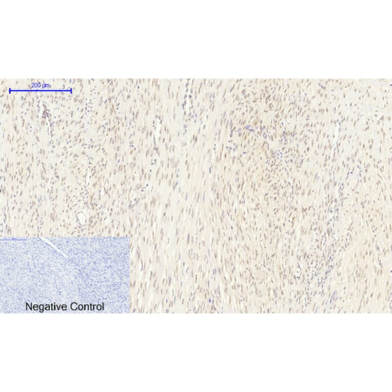 Immunohistochemistry - Anti-FKHR Antibody (B7085) - Antibodies.com