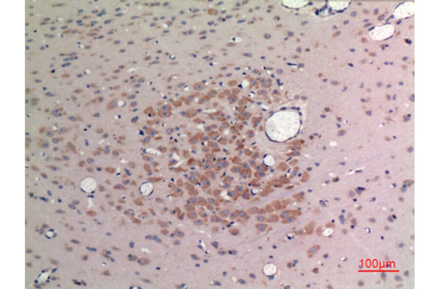 Immunohistochemistry - Anti-FGF9 Antibody (C30100) - Antibodies.com
