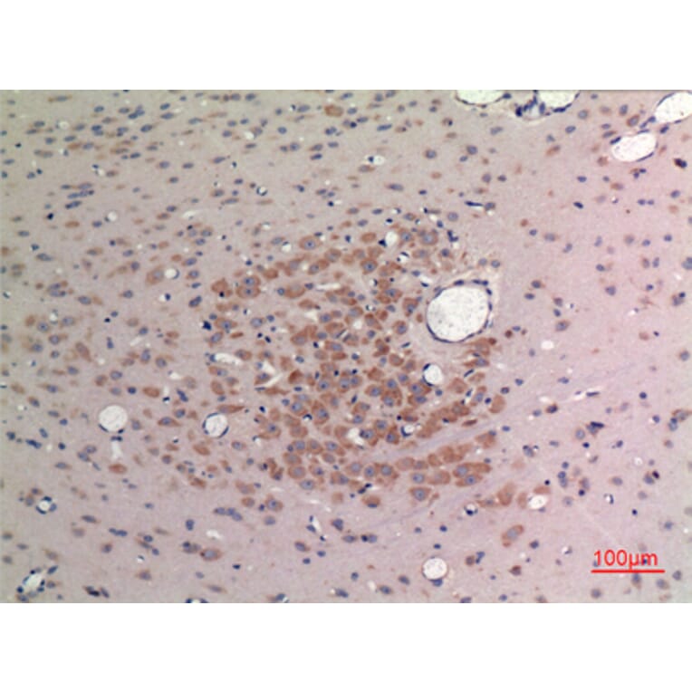 Immunohistochemistry - Anti-FGF9 Antibody (C30100) - Antibodies.com