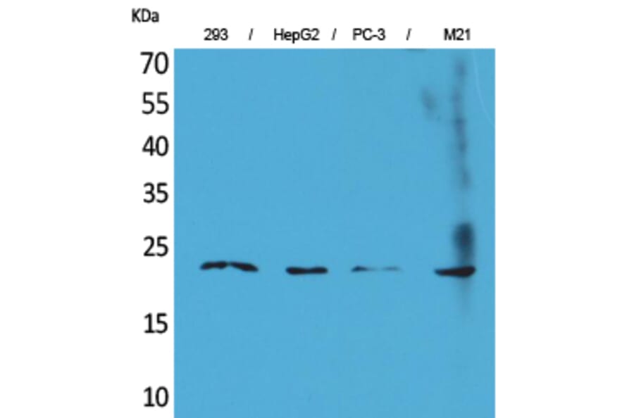 Western Blot - Anti-FGF6 Antibody (C30078) - Antibodies.com