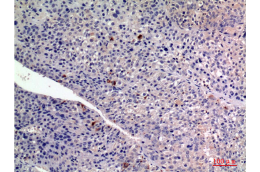 Immunohistochemistry - Anti-FGF2 Antibody (C30065) - Antibodies.com