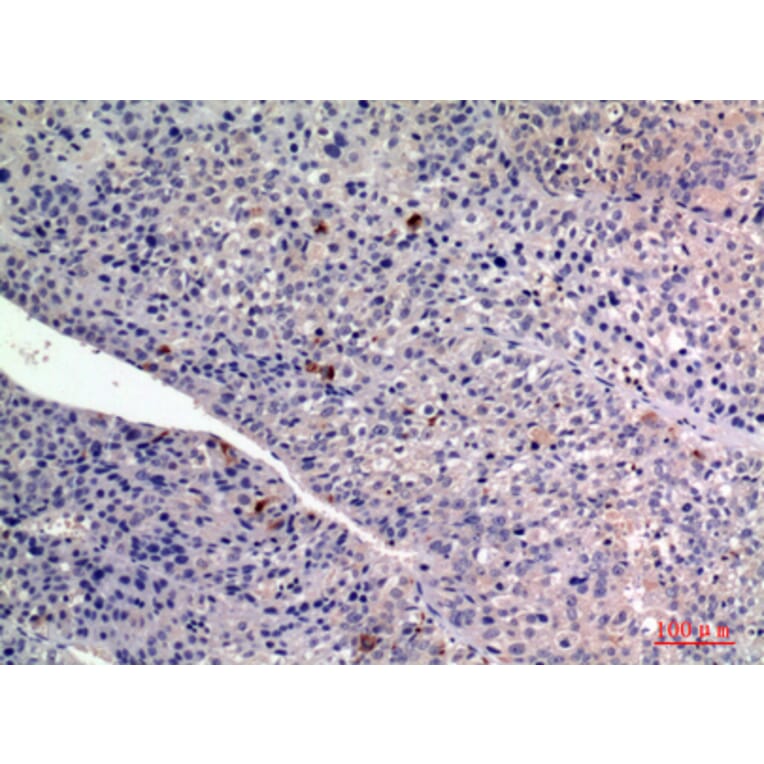 Immunohistochemistry - Anti-FGF2 Antibody (C30065) - Antibodies.com