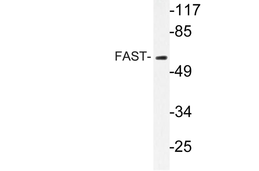 Western Blot - Anti-FAST Antibody (R12-2139) - Antibodies.com