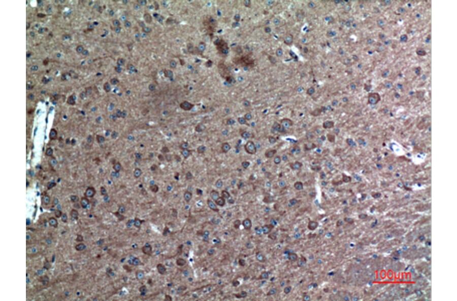 Immunohistochemistry - Anti-FAF1 Antibody (C30024) - Antibodies.com