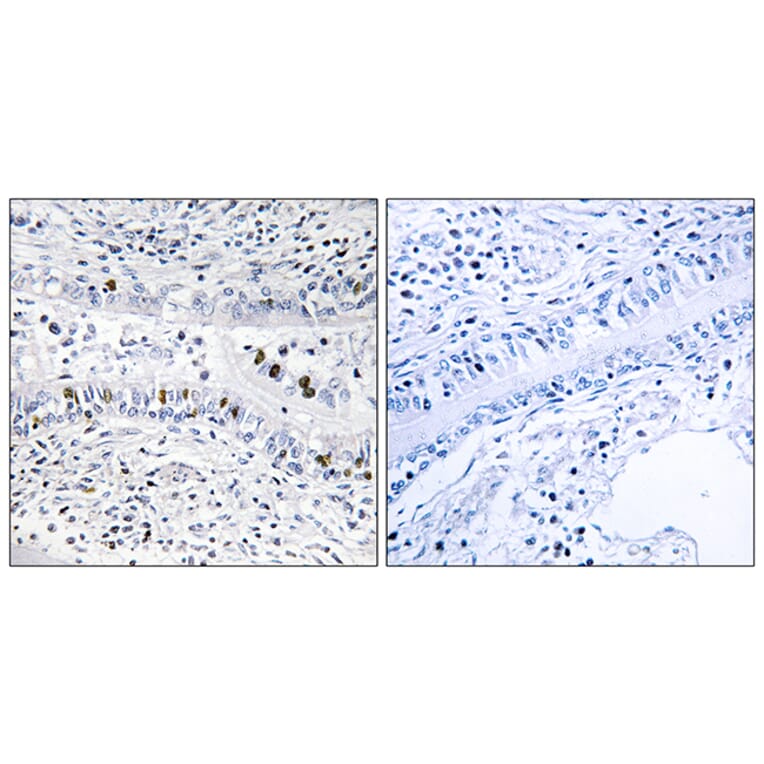 Immunohistochemistry - Anti-EZH1 Antibody (C11435) - Antibodies.com