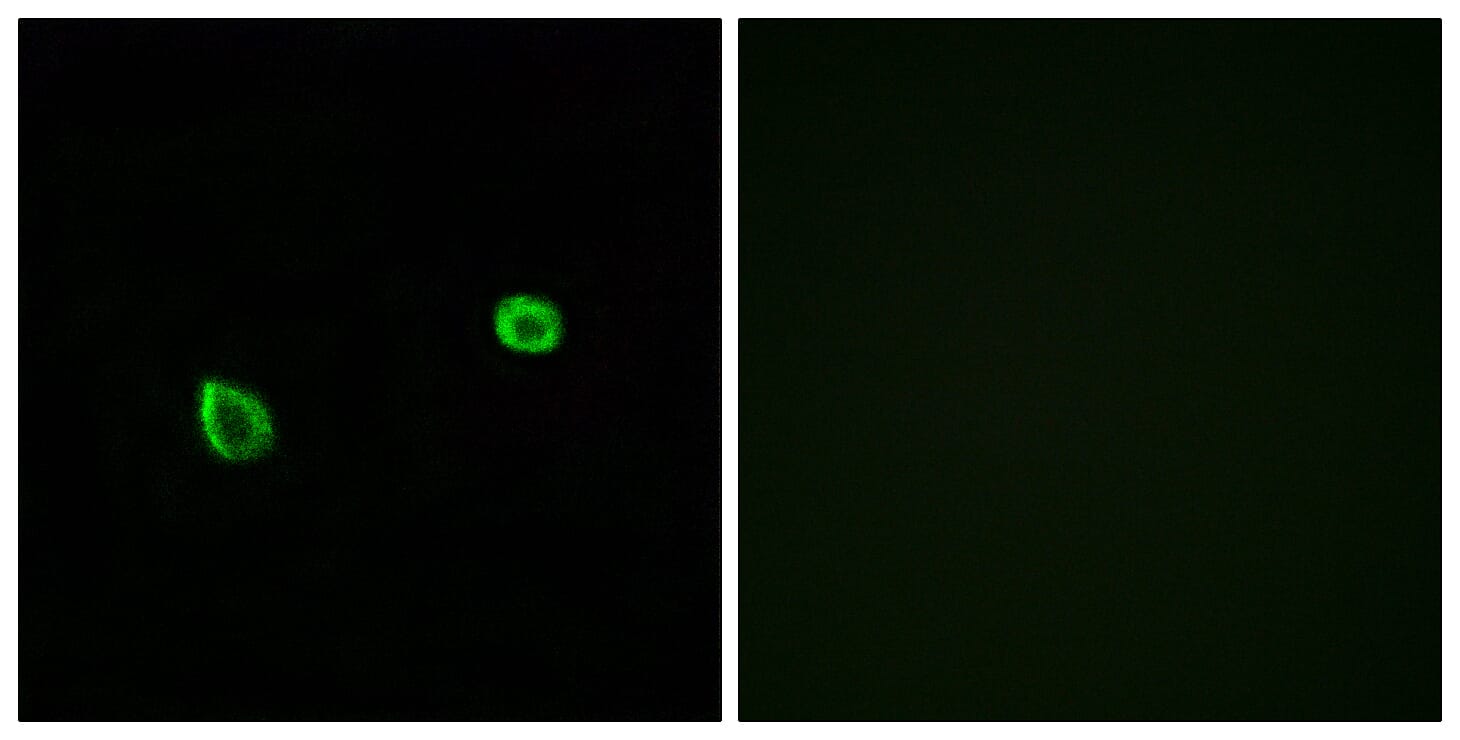 Immunofluorescence analysis of A549 cells using Anti-ERN2 Antibody. The right hand panel represents a negative control, where the antibody was pre-incubated with the immunising peptide.