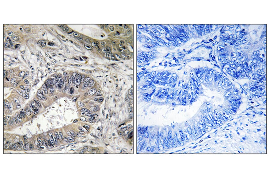 Immunohistochemistry - Anti-ERN2 Antibody (C11246) - Antibodies.com