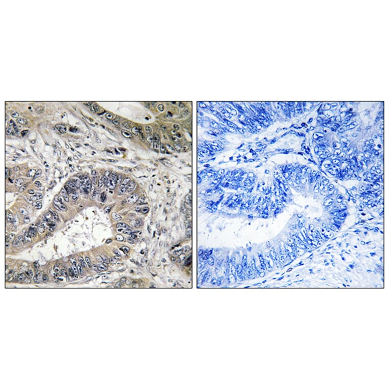 Immunohistochemistry - Anti-ERN2 Antibody (C11246) - Antibodies.com