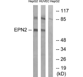 Western Blot - Anti-EPN2 Antibody (C15667) - Antibodies.com