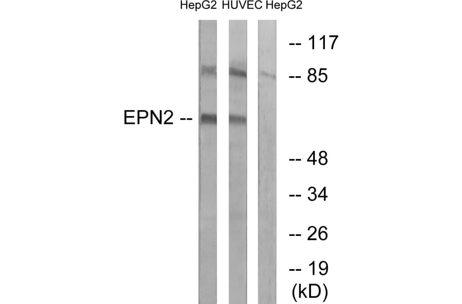 Western Blot - Anti-EPN2 Antibody (C15667) - Antibodies.com