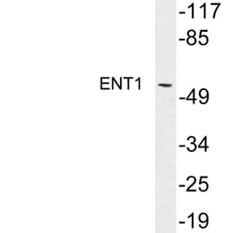 Western Blot - Anti-ENT1 Antibody (R12-2133) - Antibodies.com