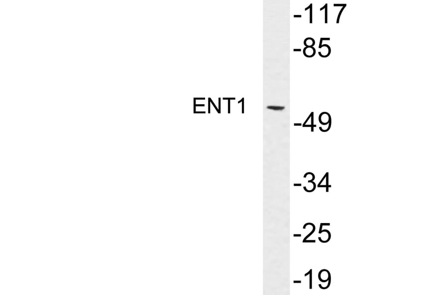 Western Blot - Anti-ENT1 Antibody (R12-2133) - Antibodies.com