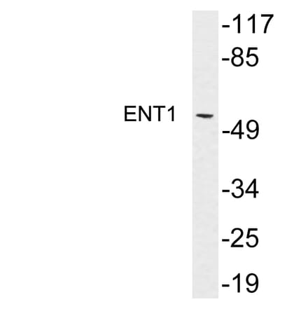 Western Blot - Anti-ENT1 Antibody (R12-2133) - Antibodies.com