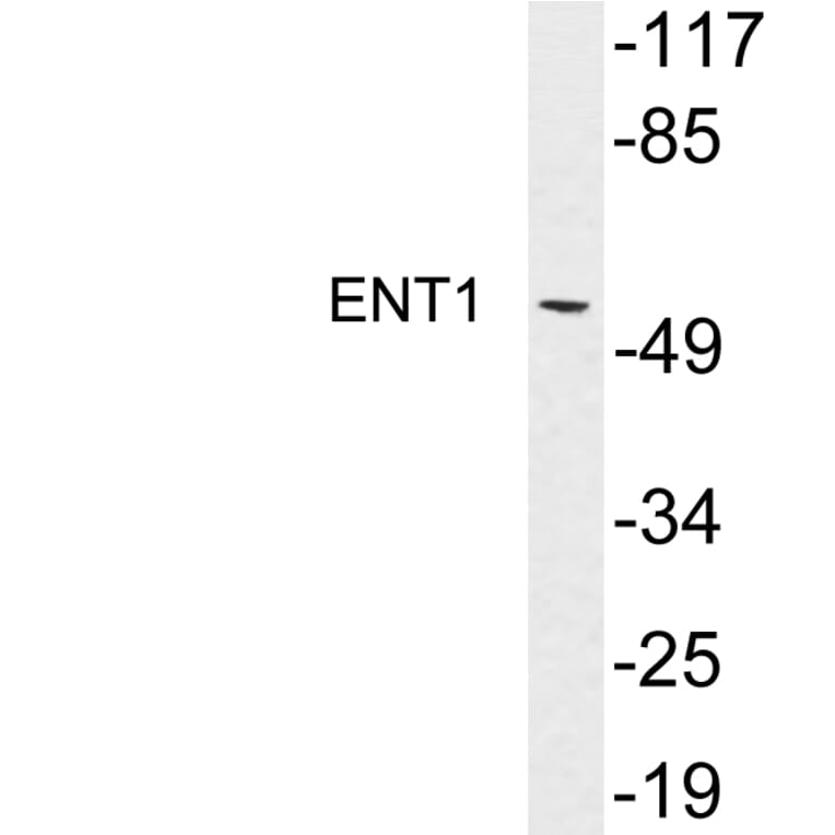 Western Blot - Anti-ENT1 Antibody (R12-2133) - Antibodies.com