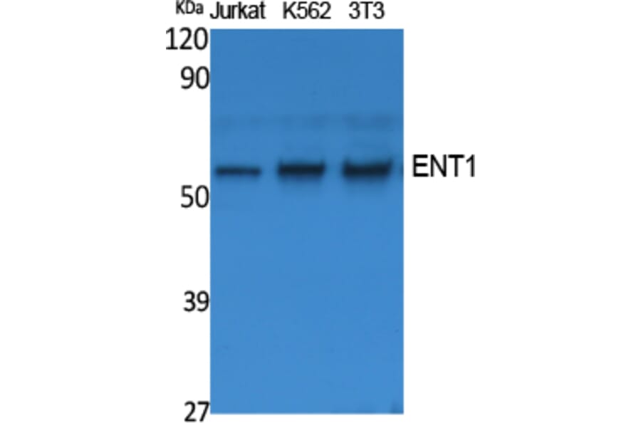 Western Blot - Anti-ENT1 Antibody (R12-2133) - Antibodies.com