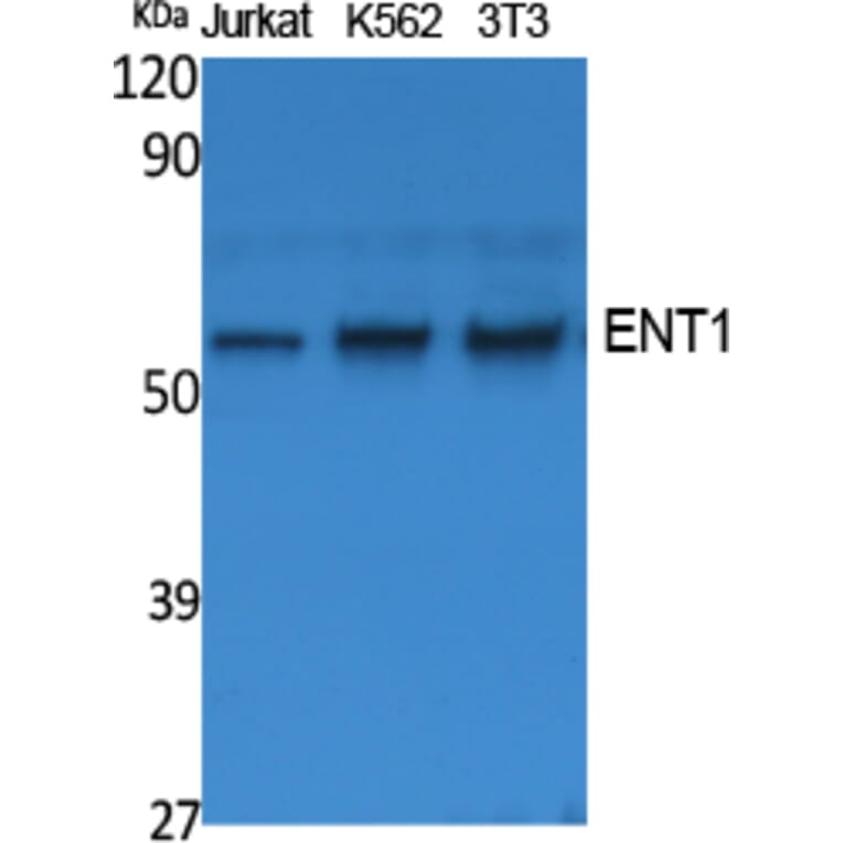 Western Blot - Anti-ENT1 Antibody (R12-2133) - Antibodies.com