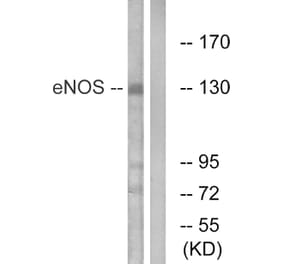 Western Blot - Anti-eNOS Antibody (B1145) - Antibodies.com