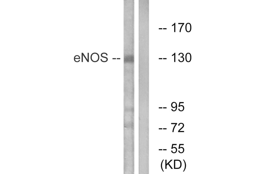 Western Blot - Anti-eNOS Antibody (B1145) - Antibodies.com