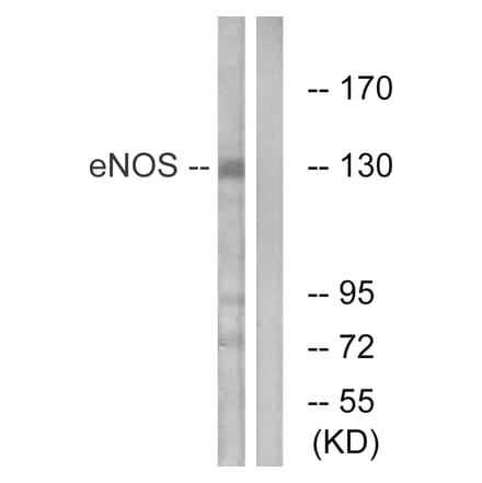 Western Blot - Anti-eNOS Antibody (B1145) - Antibodies.com