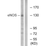 Western Blot - Anti-eNOS Antibody (B1145) - Antibodies.com