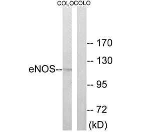 Western Blot - Anti-eNOS Antibody (B7072) - Antibodies.com