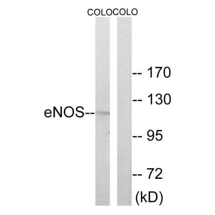 Western Blot - Anti-eNOS Antibody (B7072) - Antibodies.com