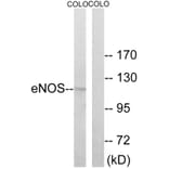 Western Blot - Anti-eNOS Antibody (B7072) - Antibodies.com