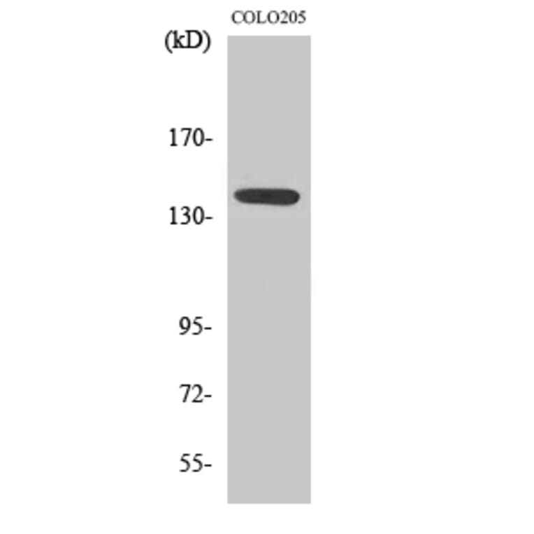 Western Blot - Anti-eNOS Antibody (B7072) - Antibodies.com