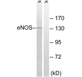 Western Blot - Anti-eNOS Antibody (B7071) - Antibodies.com