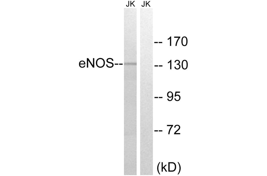 Western Blot - Anti-eNOS Antibody (B7071) - Antibodies.com