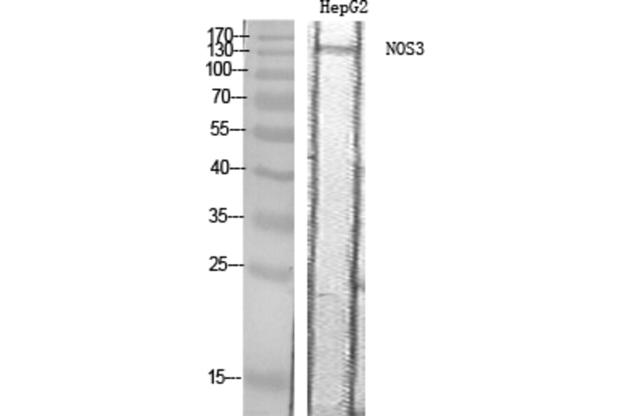 Western Blot - Anti-eNOS Antibody (B7071) - Antibodies.com