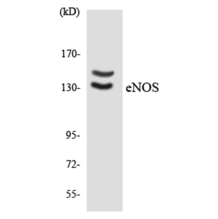 Western Blot - Anti-eNOS Antibody (R12-2750) - Antibodies.com