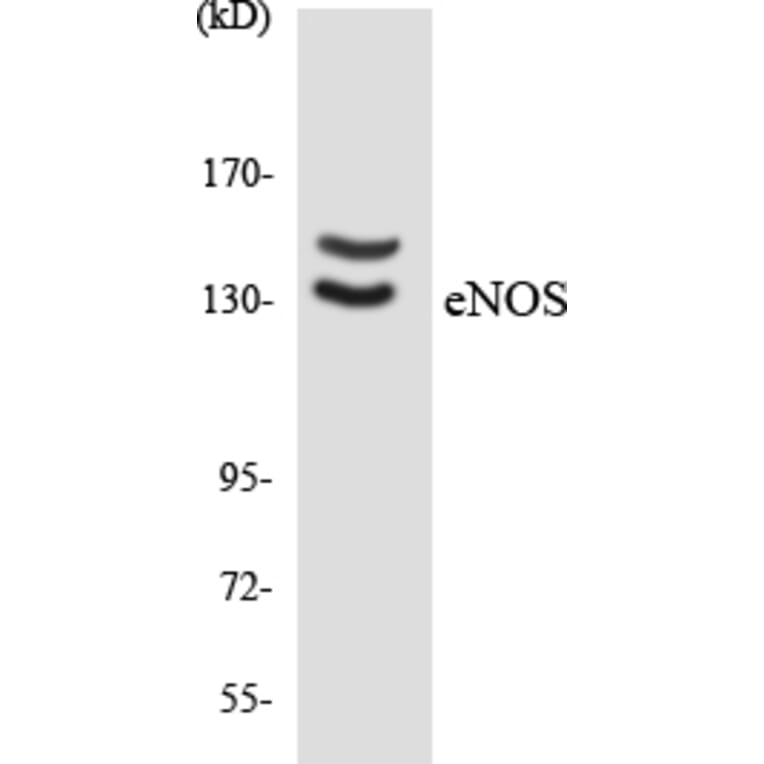 Western Blot - Anti-eNOS Antibody (R12-2750) - Antibodies.com