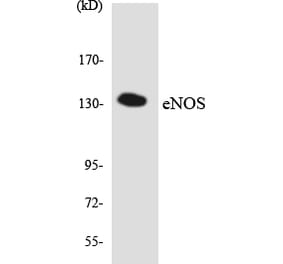Western Blot - Anti-eNOS Antibody (R12-2751) - Antibodies.com